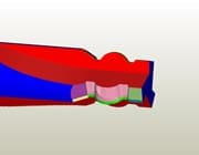 Geometry Optimization 1